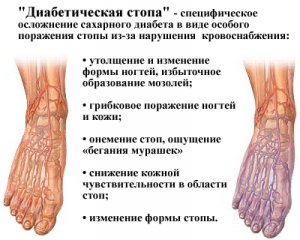 Диабетическая стопа